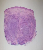 J Skin Stem Cell